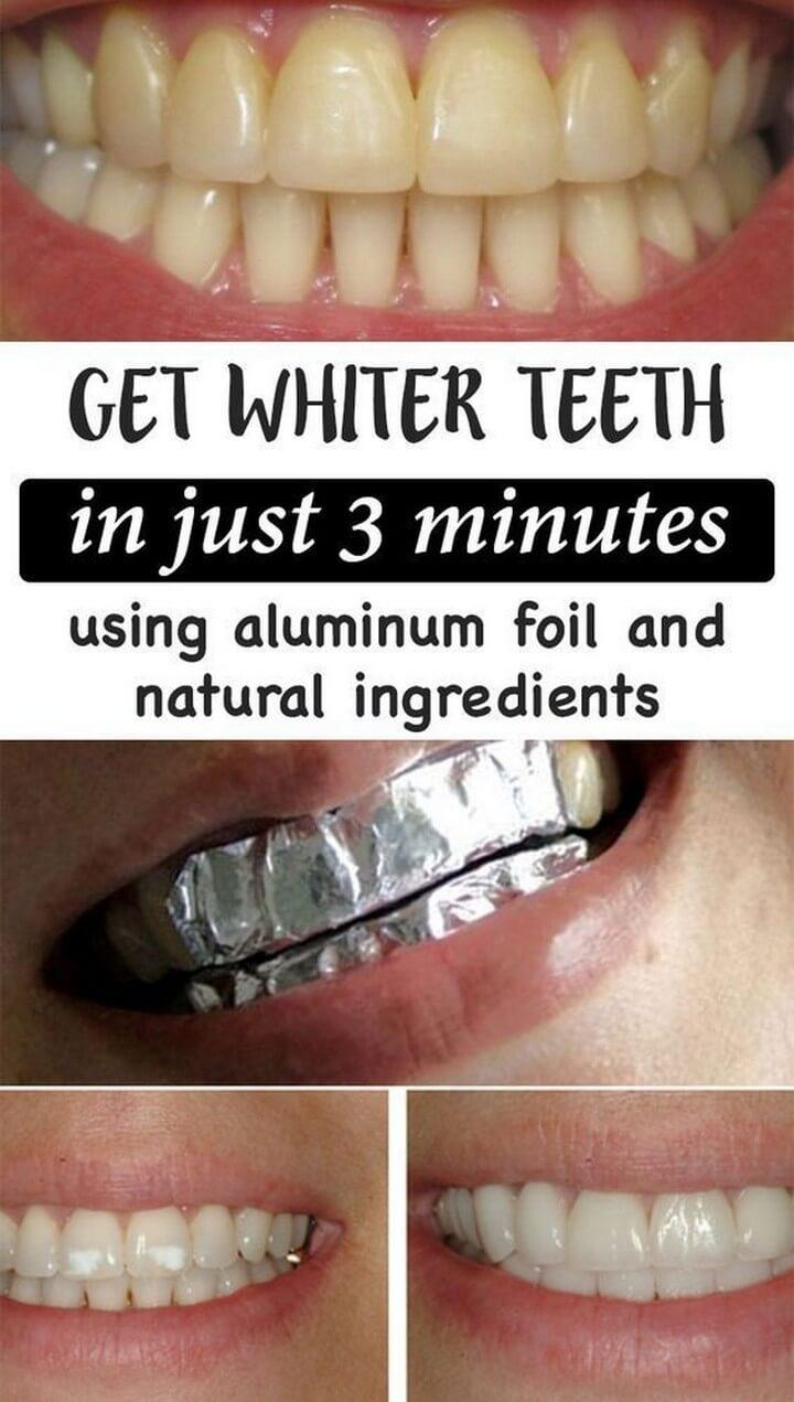 diy easy and simple teeth whitening idea